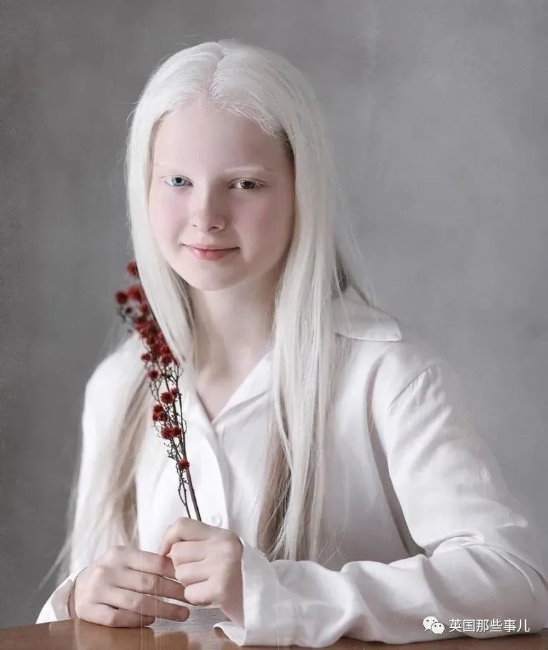 一眼冰雪 一眼森林 这个白化病 异色瞳的俄罗斯少女让网友震惊了 天天要闻