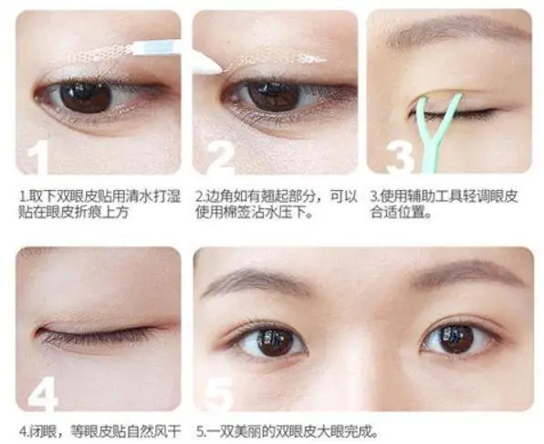 What are the pros and cons of double eyelid stickers? Will double eyelids  really change after a long time? | DayDayNews